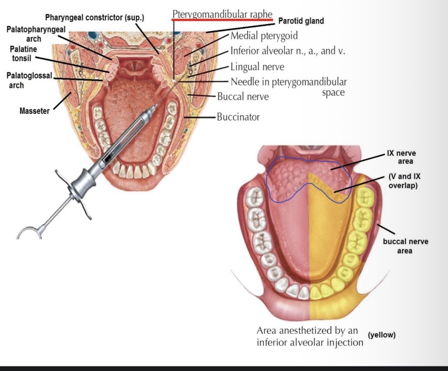 <p>Kokias struktūras nuskausmina n. alveolaris inferior blokada?</p>
