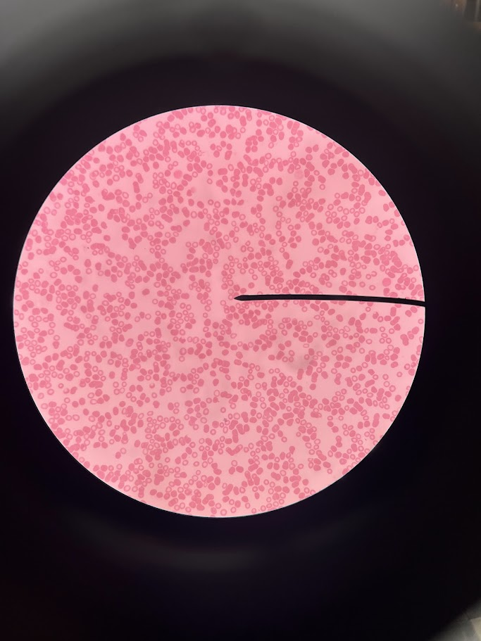 <p>This slide depicts which type of anemia</p>