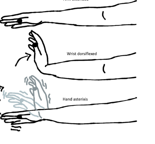 <p>What is this? What is it associated with?</p>