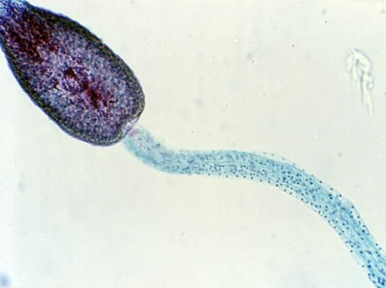<p>What helminth/fluke/parasitic worm is this?</p>