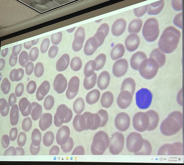 <p>The slide depicts which type of leukocytes</p>