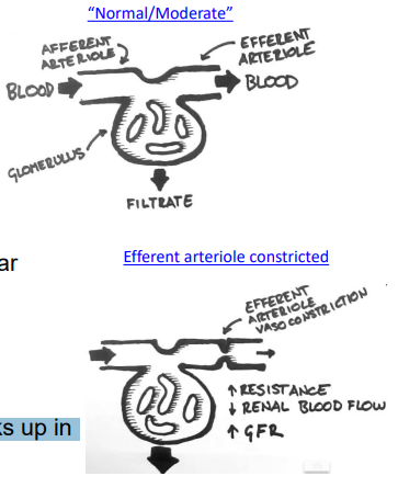 <ul><li><p>primarily SNS → arteriolar vasoconstriction (both arterioles):</p><ul><li><p>afferent: ⇓ flow into glomerulus</p></li><li><p>efferent: blood backs up in glomerulus </p></li></ul></li></ul><p></p>