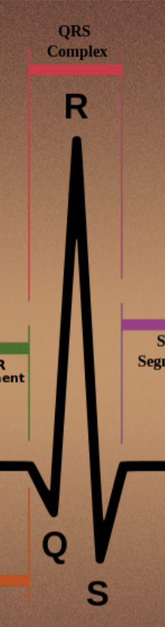 <p>QRS complex - ventricular depolarization</p>