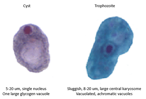 <p>Cyst: Single nuclei, large vacuole</p><p>Trophozoite: tall (wide) cell, 1 nuclei, vacuolated</p>
