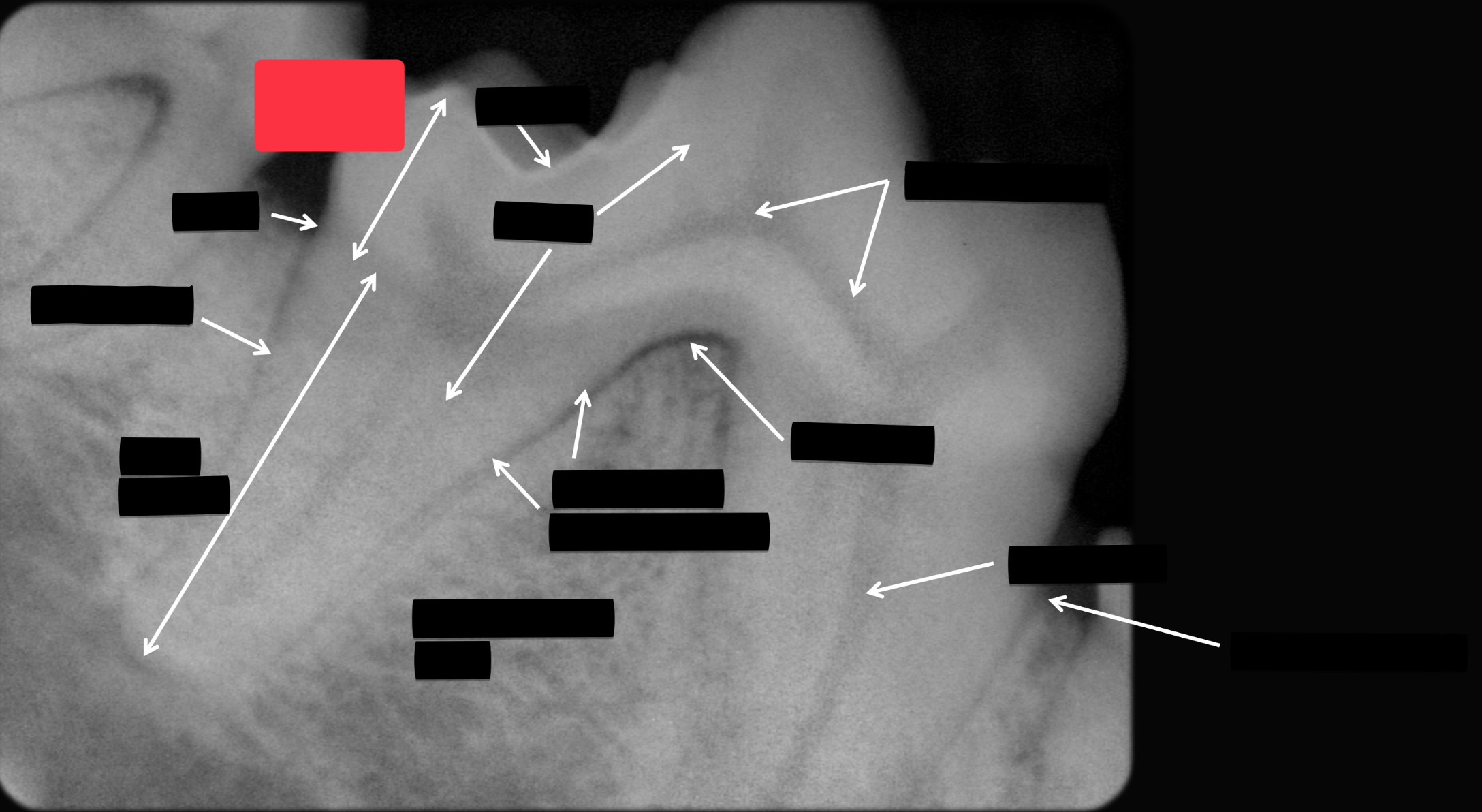 <p>Label this part of the tooth.</p>