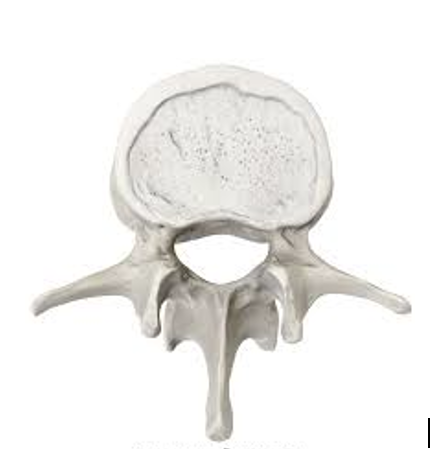<p><span style="line-height: 18.4px;"><strong>What type of vertebrae is in the following photo?</strong></span></p><p><span style="line-height: 115%;"><strong>a.</strong></span><span style="font-family: "Times New Roman"; line-height: normal; font-size: 7pt;"><strong>&nbsp;</strong></span><span style="line-height: 18.4px;">Cervical</span></p><p class="MsoNormal"><span style="line-height: 115%;"><strong>b.</strong></span><span style="font-family: "Times New Roman"; line-height: normal; font-size: 7pt;"><strong>&nbsp;</strong></span><span style="line-height: 18.4px;">Thoracic</span></p><p class="MsoNormal"><span style="line-height: 18.4px;"><strong>c. </strong>Lumbar</span></p>