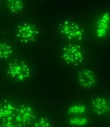 <p>discrete dots in nucleus (40-60)</p>