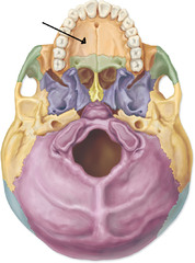<p>Roof of the mouth</p>