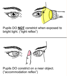 <p>What is this</p>
