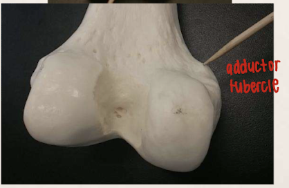 <p>Adductor tubercle of the femur</p>