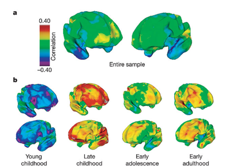 <p><span style="font-family: "Courier New"; line-height: 107%;">o</span><span style="font-family: "Times New Roman"; line-height: normal; font-size: 7pt;">&nbsp;&nbsp; </span><span style="font-family: "Times New Roman", serif; line-height: 107%;"><strong>Petite enfance</strong>&nbsp;: corrélations presque toutes négatives (couleurs froides) (QI + élevé, cortex - épais)</span></p><p class="MsoListParagraph"><span style="font-family: "Courier New"; line-height: 107%;">o</span><span style="font-family: "Times New Roman"; line-height: normal; font-size: 7pt;">&nbsp;&nbsp; </span><span style="font-family: "Times New Roman", serif; line-height: 107%;"><strong>Enfance tardive</strong>&nbsp;: corrélation positives (couleurs chaudes) (QI + élevé, cortex + épais) ; opposé de petite enfance</span></p>