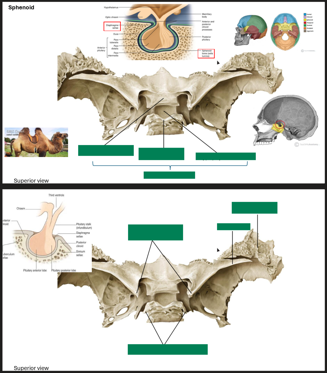 <p>Label the Sphenoid</p>