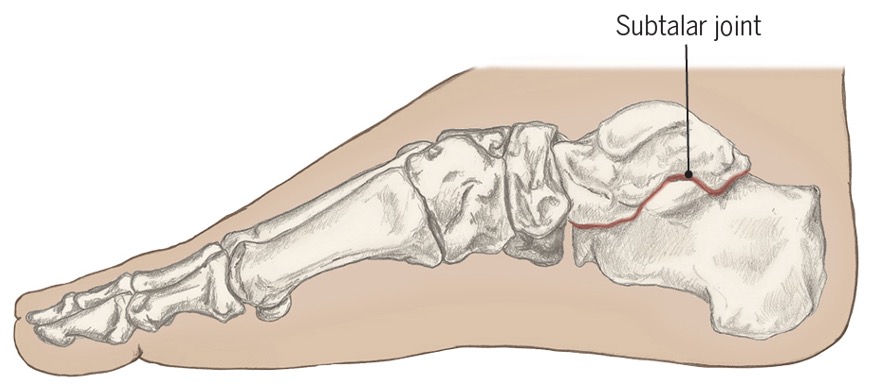 <p>«subtler joints cause inversion and eversion of the ankle</p>