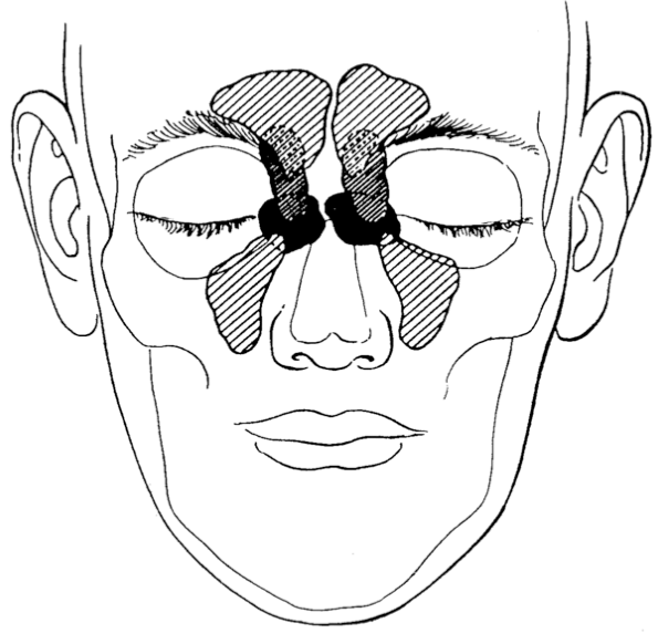 <p>where are the 4 sets of paranasal sinuses located? </p>