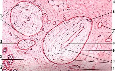 <p>A fast-adapting and extremely sensitive mechanoreceptor that is important for detecting gross pressure changes and vibration. </p><ul><li><p>Very large receptive fields</p></li><li><p>Very common throughout the body</p></li></ul><p></p>