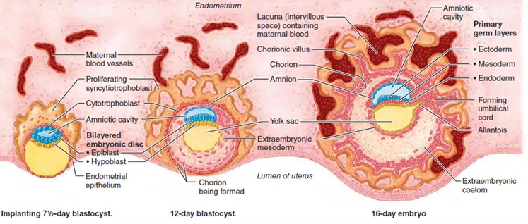 <p>CUándo ocurre la implantación?</p><ul><li><p>En el día 6</p><ul><li><p>El blastocito se implanta en la decidua materna</p></li></ul></li></ul><ul><li><p><span>Accede a los </span><strong><span>sustratos energéticos</span></strong><span> (células deciduales ricas en glucógeno) necesarios para su crecimiento.</span></p></li><li><p><span>La implantación implica:</span></p><ul><li><p><strong><span>Adhesión</span></strong></p></li><li><p><strong><span>Invasión</span></strong></p></li></ul></li></ul><p>Día 13: Invasión trofoblástica</p><ul><li><p><span>El </span><strong><span>trofoblasto</span></strong><span> erosiona más profundamente la decidua.</span></p></li><li><p><span>Se forman </span><strong><span>vacuolas</span></strong><span> que confluyen en </span><strong><span>lagunas</span></strong><span>, que luego originan el </span><strong><span>espacio intervelloso</span></strong><span>.</span></p></li></ul><p></p>