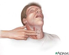 <p>Return of Spontaneous Circulation</p>