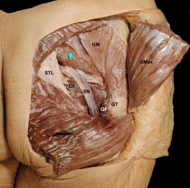 <p>Action of muscle with blue dot </p>