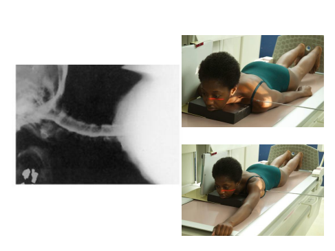 <p>Myelography (Cervical)</p>