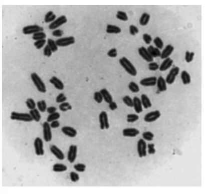 <p>Wskaż chromosomy, w których doszło do pęknięć/złamań chromatynowych.</p>