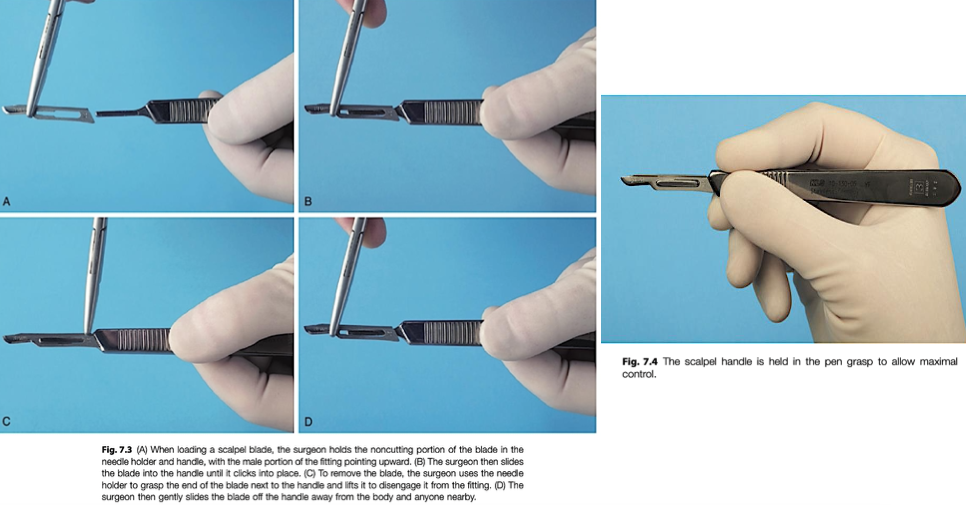 <p></p><ul><li><p>scalpel blade <span style="color: red;"><strong>insertion</strong></span><strong>:</strong></p><ul><li><p>holds the noncutting portion of the blade in the needle</p></li><li><p>grip ribbed edge with needle holder</p></li><li><p>male portion of the fitting <span style="color: red;">pointing upward</span></p></li><li><p><span style="color: red;">slide onto handle until it clicks</span></p></li><li><p>use pen grasp when making incisions</p></li></ul></li><li><p>scalpel blade<span style="color: red;"> <strong>removal</strong></span><strong>:</strong></p><ul><li><p>lift up the back end with needle holder</p></li><li><p><span style="color: red;">slide blade off away from body</span></p></li><li><p>discard in sharps container</p></li></ul></li></ul><p></p>