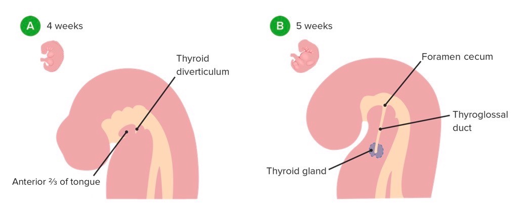 <p>-midline endodermal thickening at the foramen cecum in the floor of the primitive pharynx </p><p>-a small outpouching called the thyroid diverticulum forms and it descends from the floor of the pharynx </p><p>-the thyroid descends anteriorly to the pharynx and its migration is guided by the thyroglossal duct</p><p>-thyroid reaches its destinatino int he neck by week 7, formed of 2 lobes connected by a central isthmus </p><p>the thyroglossal duct that usually regresses by week 7-10</p>