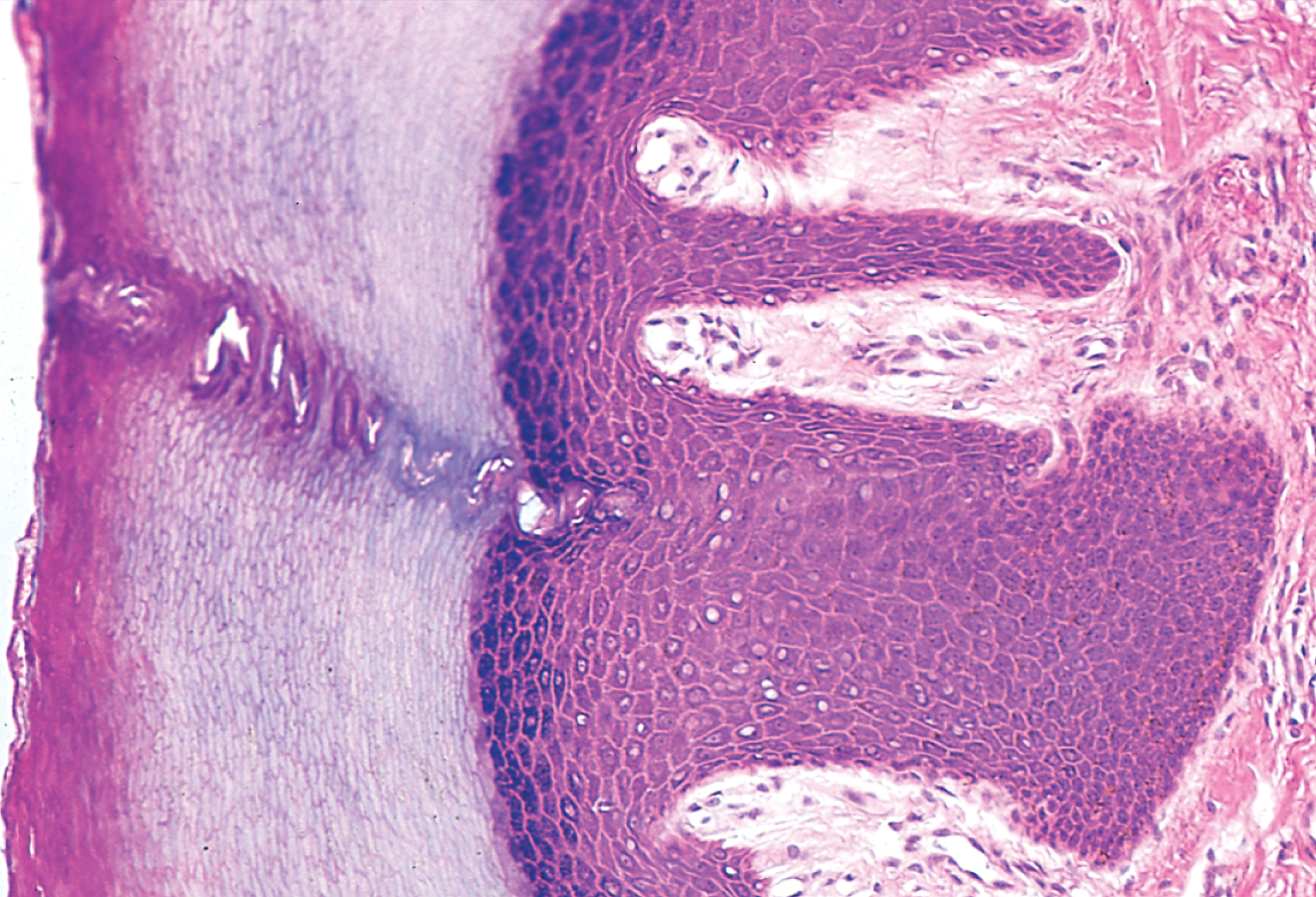 <p>Stratified Squamous Epithelium- Keratinized</p>