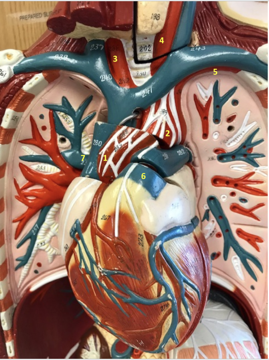 <p>Thorax/Neck</p><p>1. Ascending aorta</p><p>2. Aortic arch</p><p>3.Right common carotid artery</p><p>4.Left common carotid artery</p><p>5. Left subclavian artery</p><p>6.Pulmonary trunk</p><p>7. Right pulmonary artery</p>