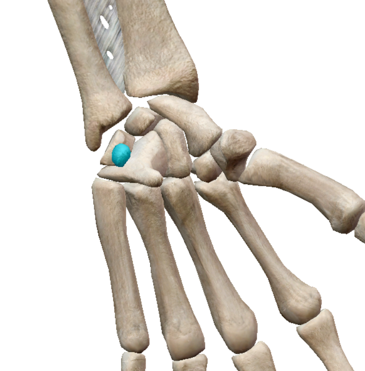 term image