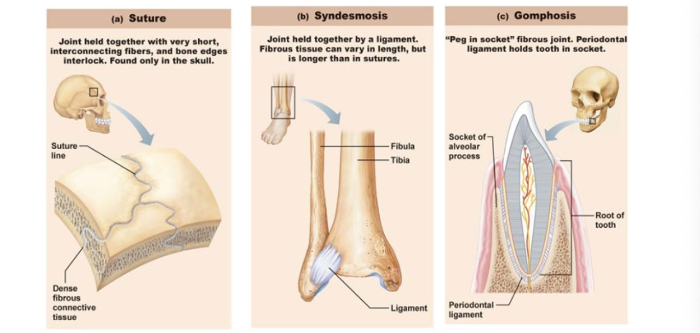 <p>Suture = HELD TOGETHER BY FIBERS</p><ul><li><p>Only in skull</p></li><li><p>Bones overlap, and fibers overlap</p></li></ul><p>Syndesmosis</p><ul><li><p>JOINT HELD BY LIGAMENT</p></li></ul><p>Gomphosis</p><ul><li><p>HOLD TOOTH</p></li></ul><p></p>