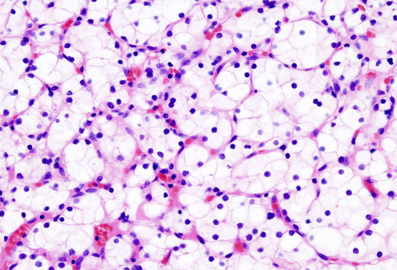 <p>Hematoxylin and Eosin</p>