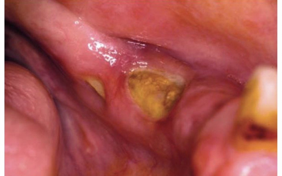 <p>CHẨN ĐOÁN ?</p>