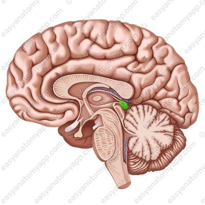term image