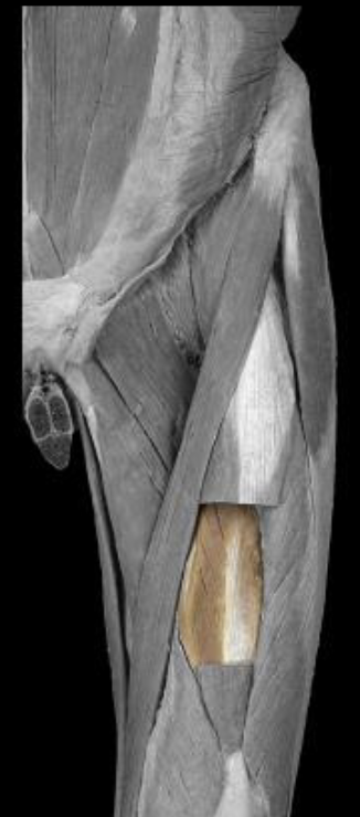 <p>origin of vastus intermedius</p>
