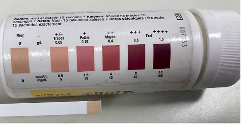 <p>Acetoacetic acid</p>