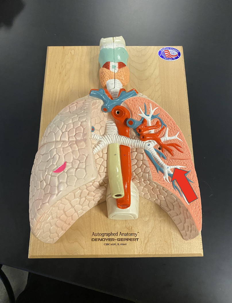 <p>Identify the highlighted structure (space between rings, deep inside lungs)</p>