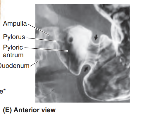 knowt flashcard image