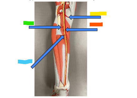 <p>What is the yellow arrow?</p>