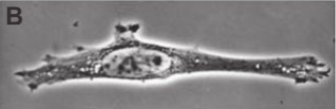 <p>a type of light microscope, good for cultured cells since it doesn’t require staining</p>