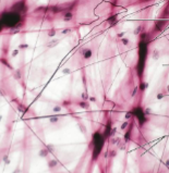 <p>CT Proper Loose:</p><p>Areolar Connective</p><p>Tissue</p>