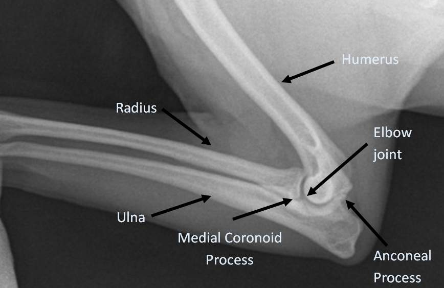 <p>Hinge joints </p>