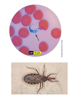 <p>Chagas Disease</p>