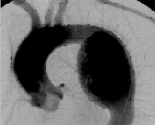 <p>This is an example of </p>