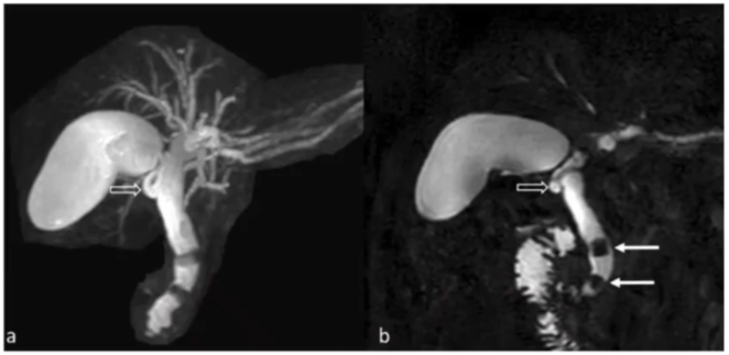 <p>type of imaging used</p>