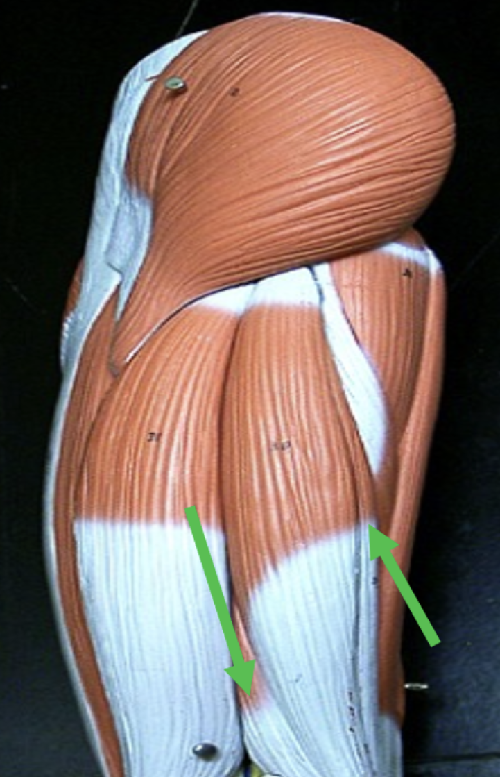<p>Identify the muscle indicated by the pointer.</p>