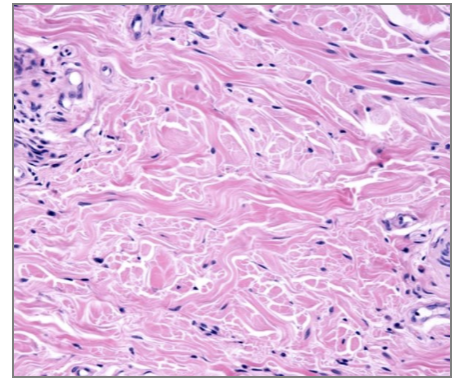 <p>identify tissue</p>