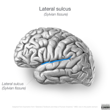 <p>frontal and temporal lobes</p>