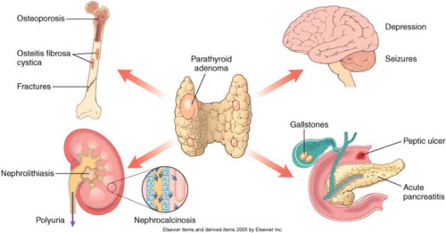 <p>TRANSLATION: психическая секреция</p><p>DEFINITION: the production of digestive juices triggered by thoughts or feelings, not by food</p><p>EXAMPLE: Pavlov discovered that dogs produce ........................ just by seeing or smelling food. Павлов обнаружил, что у собак возникает ПСИХИЧЕСКАЯ СЕКРЕЦИЯ только при виде или запахе еды.</p>