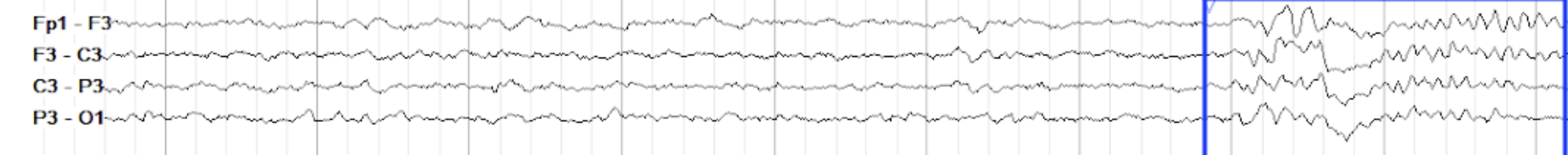 <p>negative, positive, then something else </p>