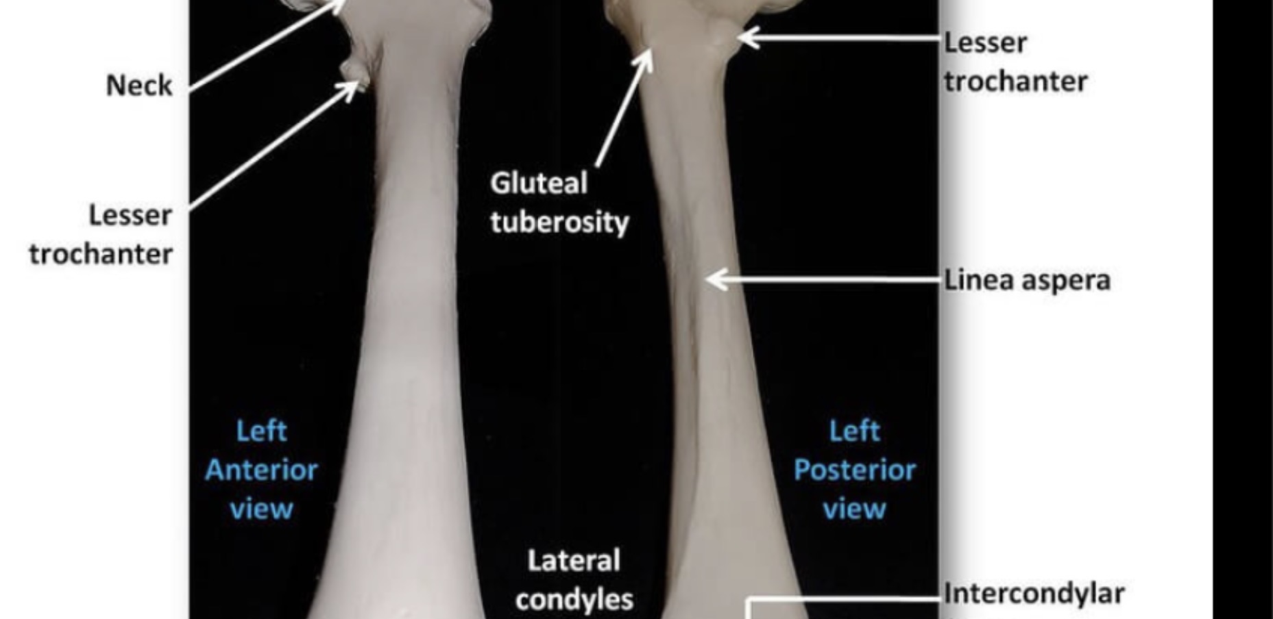 <p>A longitudinal crest on the posterior shaft</p>